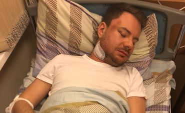 Сломанная челюсть и черепно-мозговые травмы: DJ Smash жестоко избили