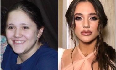 Холостяк 10 сезон: Даша изменила внешность с помощью похудения и пластики