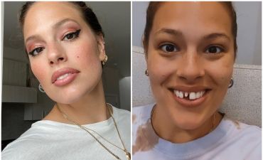 Эшли Грэм сломала зуб