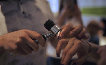 Профілактика меланоми