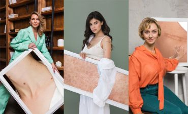 Марина Боржемская, Мишель Андраде, Римма Зюбина: 16 звезд стали лицами проекта против рака кожи