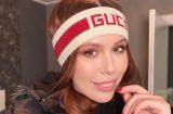 Соня Плакидюк рассказала, как поборола проблемы с кожей