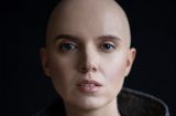 Я втратила волосся, брови, вії, у мені мінус пару органів: у Яніни Соколової діагностували рак