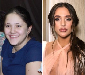 Холостяк 10 сезон: Даша изменила внешность с помощью похудения и пластики