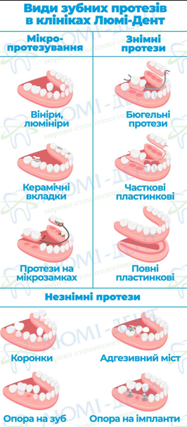 Новая улыбка без секретов: какое протезирование выбрать - Фото №1