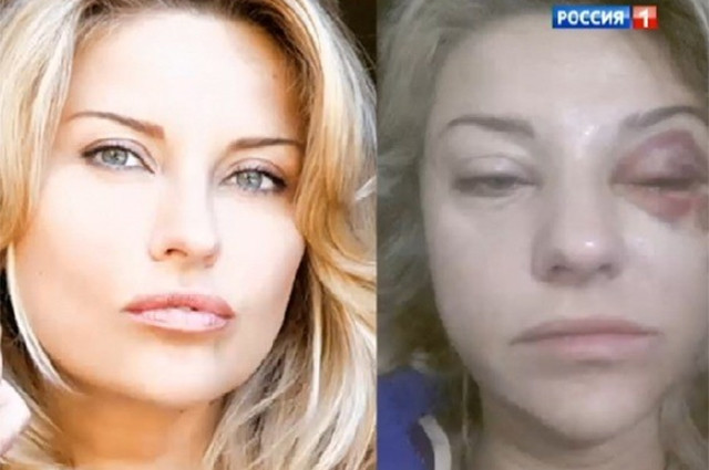 Марат Башаров избил жену