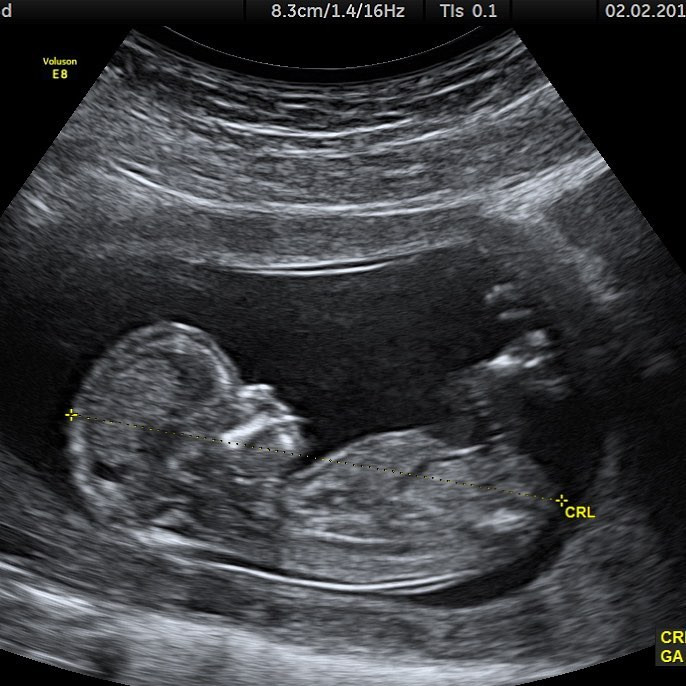 Джастин Бибер впервые станет отцом?