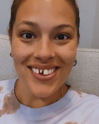 Эшли Грэм сломала зуб